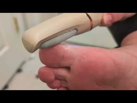 12-in-1 Electric Callus Remover for Softer Feet - Haootadiy